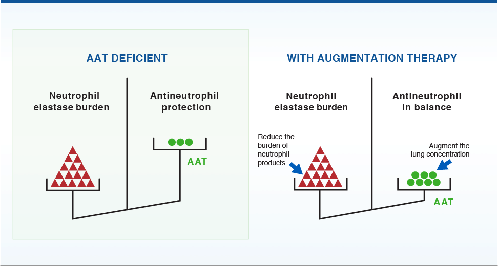 Treatment of alpha-1 with augmentation therapy graph